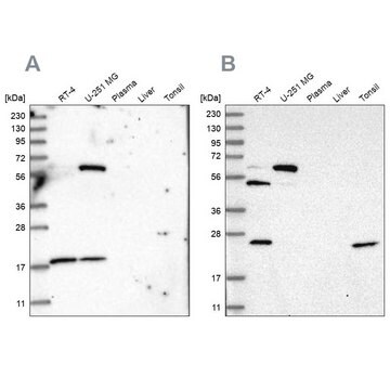 Anti-PYROXD2 antibody produced in rabbit Prestige Antibodies&#174; Powered by Atlas Antibodies, affinity isolated antibody, buffered aqueous glycerol solution