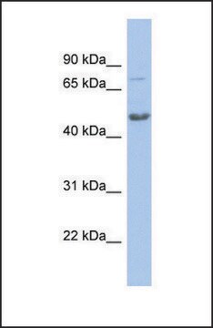 Anti-CBX8, (N-terminal) antibody produced in rabbit affinity isolated antibody