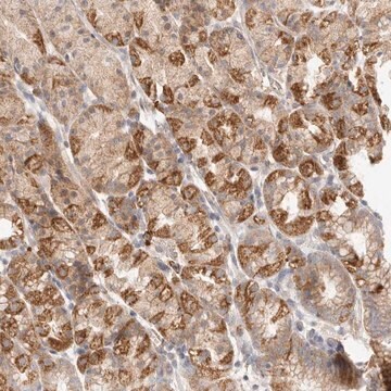 Anti-SLC25A36 antibody produced in rabbit Prestige Antibodies&#174; Powered by Atlas Antibodies, affinity isolated antibody, buffered aqueous glycerol solution