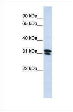 Anti-RNF182 (ab1) antibody produced in rabbit affinity isolated antibody