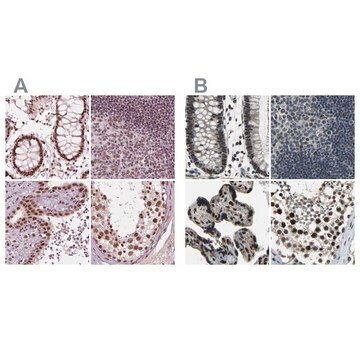 Anti-ELF2 antibody produced in rabbit Prestige Antibodies&#174; Powered by Atlas Antibodies, affinity isolated antibody, buffered aqueous glycerol solution