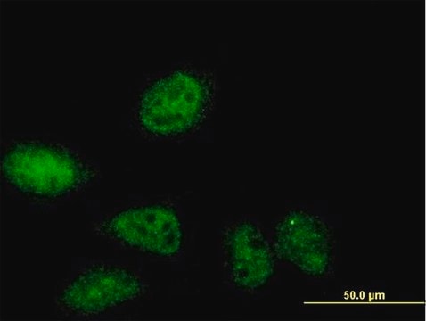 Anti-SERTAD2 antibody produced in mouse purified immunoglobulin, buffered aqueous solution