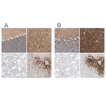 Anti-GLUL antibody produced in rabbit Ab2, Prestige Antibodies&#174; Powered by Atlas Antibodies, affinity isolated antibody, buffered aqueous glycerol solution