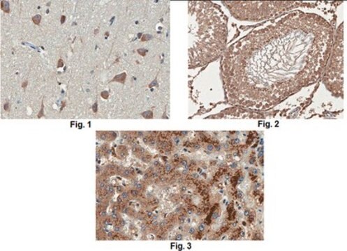 Anti-beta-Arrestin-2 Antibody, clone 5E12.1 clone 5E12.1, from mouse