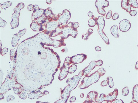 Anti-Cytokeratin, pan antibody, Mouse monoclonal clone PCK-26, purified from hybridoma cell culture