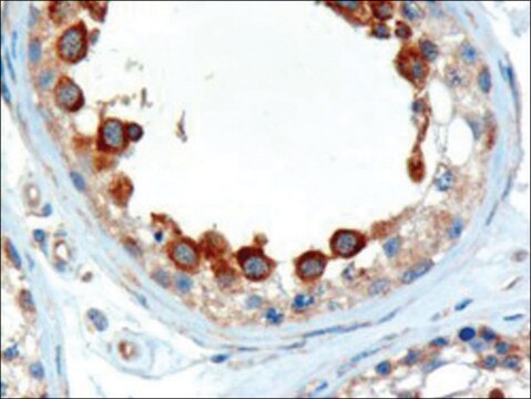 Anti-ALMS1 antibody produced in goat affinity isolated antibody, buffered aqueous solution