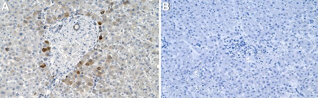 Anti-SCD Antibody, clone 2C2 ZooMAb&#174; Rabbit Monoclonal recombinant, expressed in HEK 293 cells