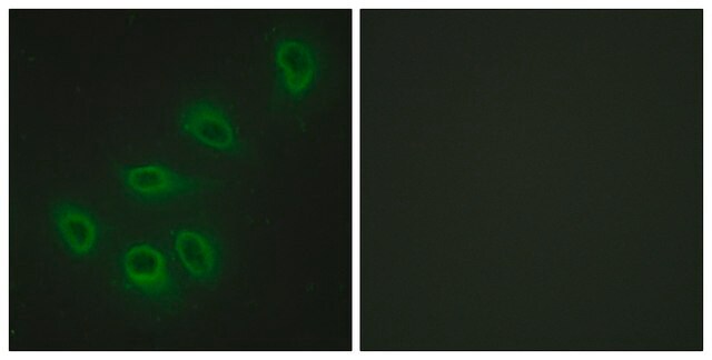 抗-ENOS 兔抗 affinity isolated antibody