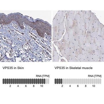 Anti-VPS35 antibody produced in rabbit Prestige Antibodies&#174; Powered by Atlas Antibodies, affinity isolated antibody, buffered aqueous glycerol solution