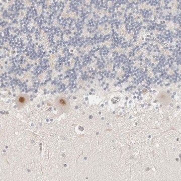 Anti-TSEN2 antibody produced in rabbit Prestige Antibodies&#174; Powered by Atlas Antibodies, affinity isolated antibody, buffered aqueous glycerol solution, ab1