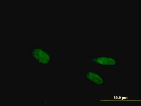 抗VDR抗体 マウス宿主抗体 purified immunoglobulin, buffered aqueous solution