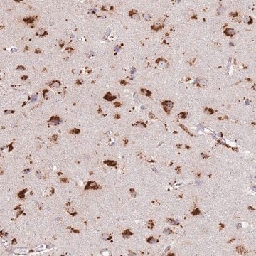 Anti-TMEM229B antibody produced in rabbit Prestige Antibodies&#174; Powered by Atlas Antibodies, affinity isolated antibody, buffered aqueous glycerol solution