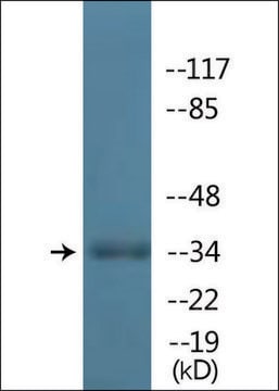 Anti-phospho-TAL-1 (pSer122) antibody produced in rabbit affinity isolated antibody