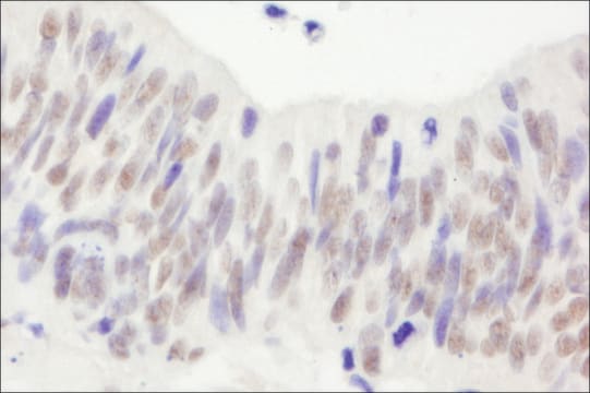 Rabbit anti-NBS1 Antibody, Affinity Purified Powered by Bethyl Laboratories, Inc.