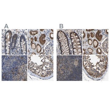 Anti-FHIT antibody produced in rabbit Prestige Antibodies&#174; Powered by Atlas Antibodies, affinity isolated antibody, buffered aqueous glycerol solution