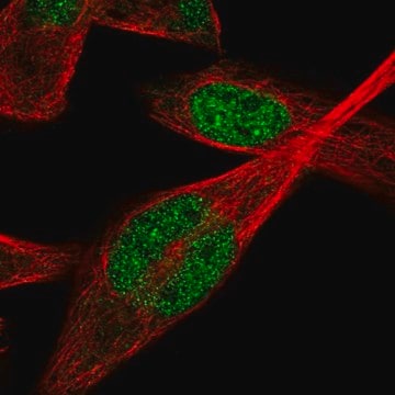 Anti-IPMK antibody produced in rabbit Prestige Antibodies&#174; Powered by Atlas Antibodies, affinity isolated antibody