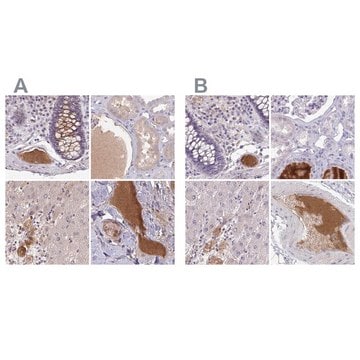 Anti-HGFAC antibody produced in rabbit Prestige Antibodies&#174; Powered by Atlas Antibodies, affinity isolated antibody, buffered aqueous glycerol solution