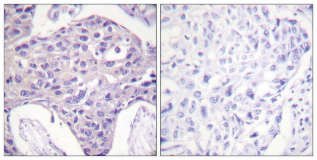 Anti-FOXO1 antibody produced in rabbit affinity isolated antibody