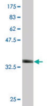 Monoclonal Anti-GALK1 antibody produced in mouse clone 2E9, purified immunoglobulin, buffered aqueous solution