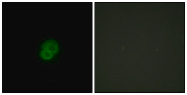 Anti-ARMCX2 antibody produced in rabbit affinity isolated antibody