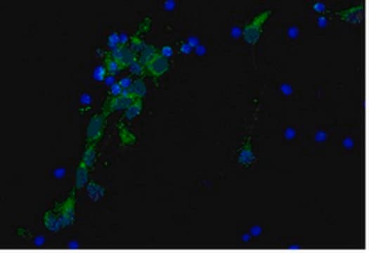 Anti-Alzheimer Precursor Protein A4 Antibody, clone 22C11, Biotin Conj. | MAB348B clone 22C11, from mouse, biotin conjugate