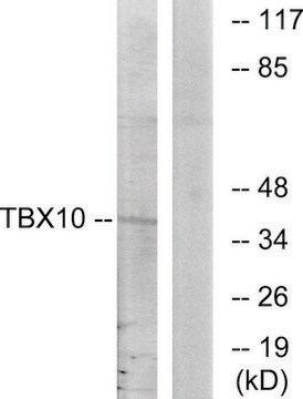 Anti-TBX10 antibody produced in rabbit affinity isolated antibody