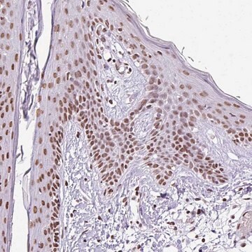 Anti-RARG antibody produced in rabbit Prestige Antibodies&#174; Powered by Atlas Antibodies, affinity isolated antibody, buffered aqueous glycerol solution