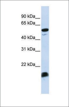 Anti-C4BPA antibody produced in rabbit affinity isolated antibody