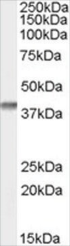 Anti-SFRP2 antibody produced in goat affinity isolated antibody, buffered aqueous solution