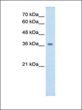 Anti-WNT16 antibody produced in rabbit IgG fraction of antiserum