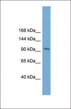 Anti-STK31, (N-terminal) antibody produced in rabbit affinity isolated antibody