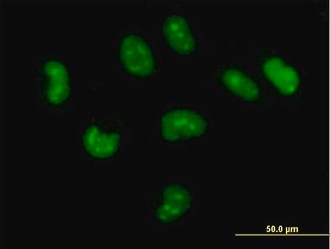 Anti-CUTC antibody produced in mouse purified immunoglobulin, buffered aqueous solution