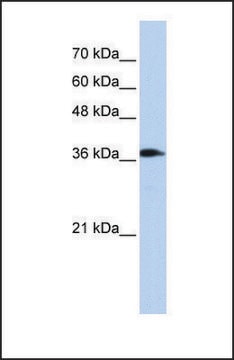 Anti-ATP6V0D2 antibody produced in rabbit affinity isolated antibody