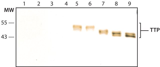 Anti-TTP (N-terminal) antibody produced in rabbit ~1.0&#160;mg/mL, affinity isolated antibody, buffered aqueous solution