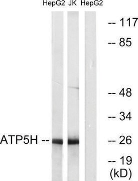 Anti-ATP5H antibody produced in rabbit affinity isolated antibody