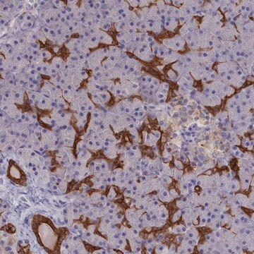 Anti-WDR6 antibody produced in rabbit Prestige Antibodies&#174; Powered by Atlas Antibodies, affinity isolated antibody, buffered aqueous glycerol solution