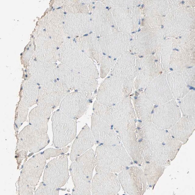 Anti Eif4g2 Antibody Produced In Rabbit Prestige Antibodies Powered By Atlas Antibodies Affinity Isolated Antibody Buffered Aqueous Glycerol Solution Ab1