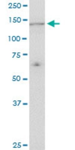 Monoclonal Anti Ube4a Antibody Produced In Mouse Clone 1g8 Purified Immunoglobulin Buffered Aqueous Solution