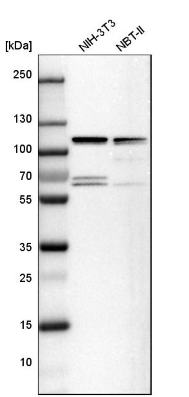 Anti Eif4g2 Antibody Produced In Rabbit Prestige Antibodies Powered By Atlas Antibodies Affinity Isolated Antibody Buffered Aqueous Glycerol Solution Ab1