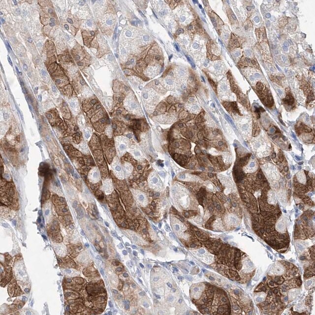 Anti Asns Antibody Produced In Rabbit Prestige Antibodies Powered By Atlas Antibodies Affinity Isolated Antibody Buffered Aqueous Glycerol Solution