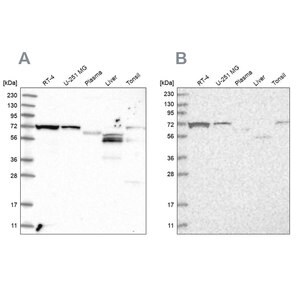 Anti-SLC25A23 antibody produced in rabbit Prestige Antibodies® Powered ...