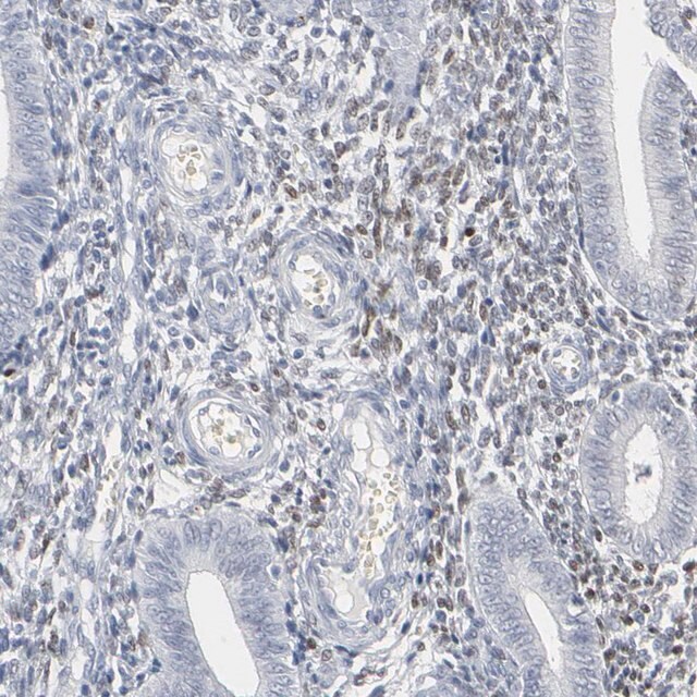 Anti Mitf Antibody Produced In Rabbit Prestige Antibodies Powered By Atlas Antibodies Affinity Isolated Antibody Buffered Aqueous Glycerol Solution