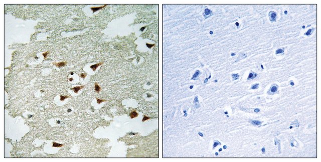 ANTI-AKT ANTIBODY PRODUCE | Merck Life Sciences Thailand