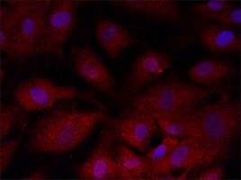 Anti Gsdmd 126 138 Antibody Produced In Rabbit Igg Fraction Of Antiserum Buffered Aqueous Solution