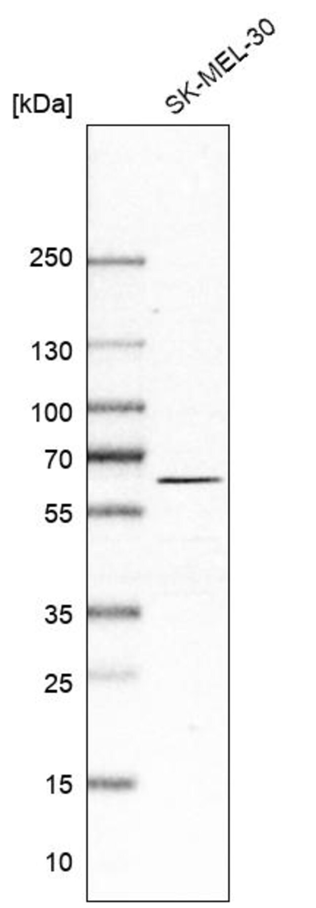 Anti Asns Antibody Produced In Rabbit Prestige Antibodies Powered By Atlas Antibodies Affinity Isolated Antibody Buffered Aqueous Glycerol Solution