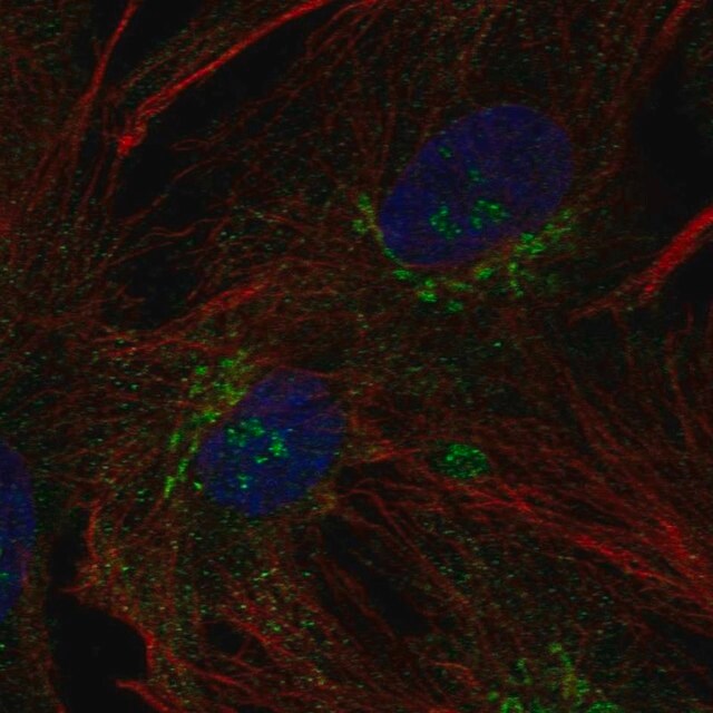 Anti B3gnt9 Antibody Produced In Rabbit Prestige Antibodies Powered By Atlas Antibodies Affinity Isolated Antibody