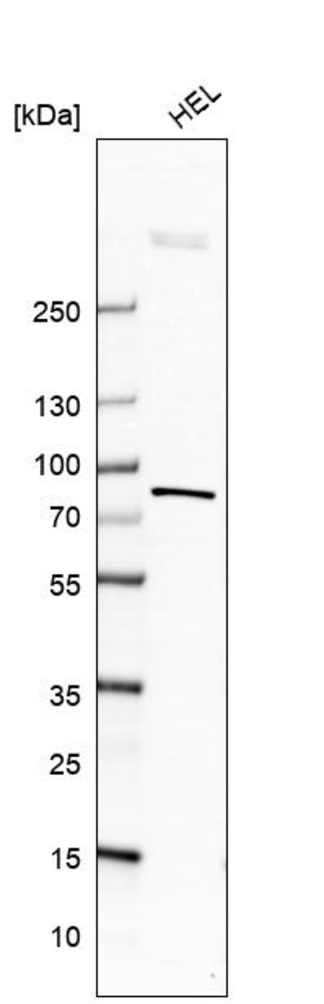 Anti Acsl4 Antibody Produced In Rabbit Ab2 Prestige Antibodies Powered By Atlas Antibodies Affinity Isolated Antibody Buffered Aqueous Glycerol Solution