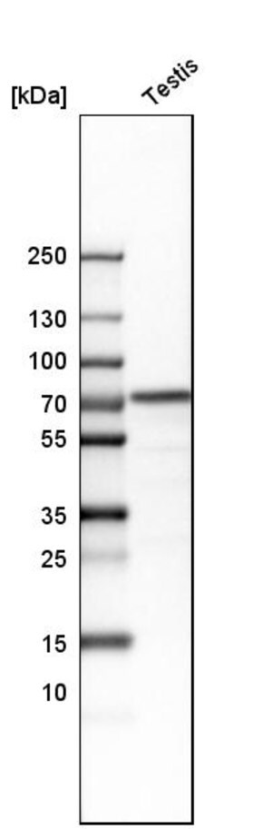 Anti Hspa2 Antibody Produced In Rabbit Prestige Antibodies Powered By Atlas Antibodies Affinity Isolated Antibody Buffered Aqueous Glycerol Solution