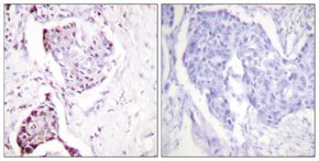 Anti Ubiquitin Antibody Produced In Rabbit Rps27a Uba80