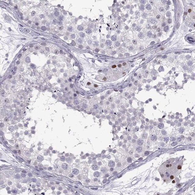 Anti C16orf59 Antibody Produced In Rabbit Prestige Antibodies Powered By Atlas Antibodies Affinity Isolated Antibody